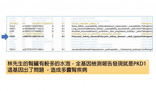 多囊腎的基因異常
