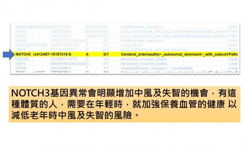 造成中風及失智的NOTCH3基因變異