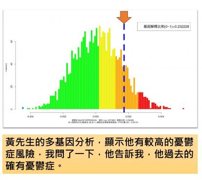 多基因因素造成的憂鬱症