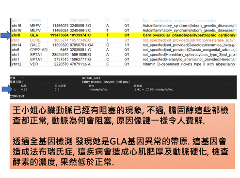 法布瑞氏症造成的不明原因心血管阻塞