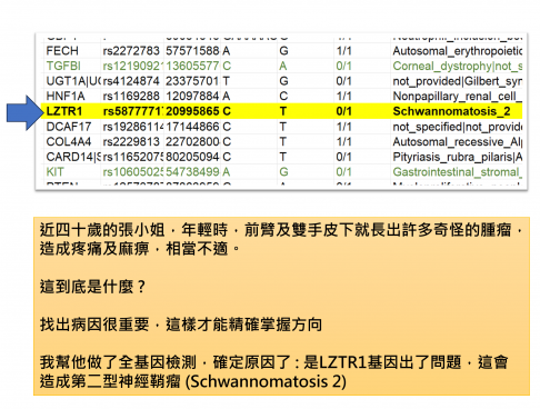 奇怪的手部腫瘤及基因異常