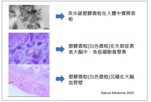 塑膠微粒在大腦中長什麼樣子