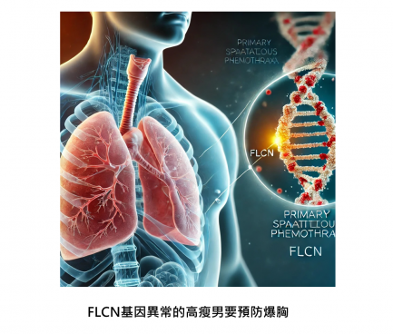「爆胸地雷！FLCN基因異常加高瘦男容易發生『自發性氣胸』