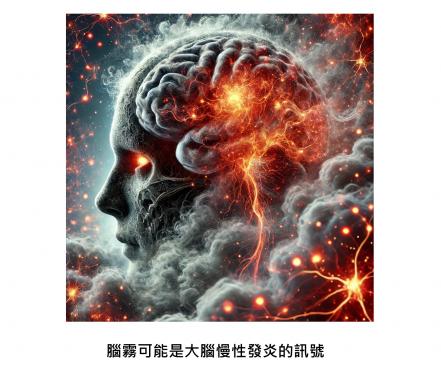 「腦霧」＝ 大腦慢性發炎，腦袋卡住的感覺，其實是大腦在求救