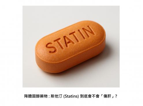 顛覆認知 : 降膽固醇藥物斯他汀其實會救肝