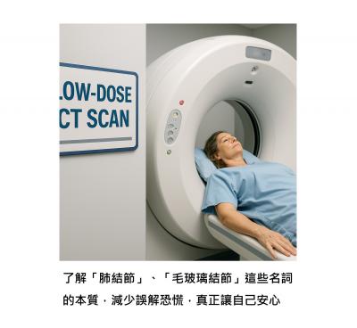 肺結節、毛玻璃結節到底是什麼？對健康有什麼影響？