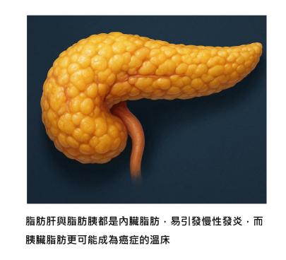 脂肪胰不是小事 - 當油住進胰臟，細胞命運就悄悄改寫