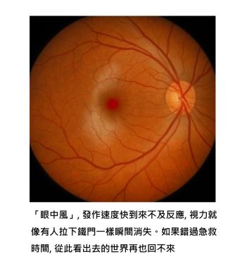 眼睛也會中風, 而且來得比想像還快 - 視力突然黑掉, 分分秒秒都在跟時間賽跑