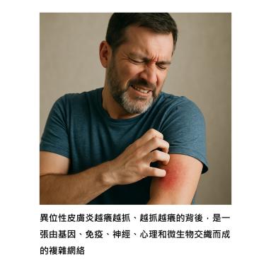 異位性皮膚炎不再是宿命 - 陪您找到生活的解方