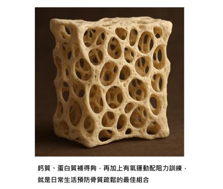 骨質疏鬆永遠是預防重於治療