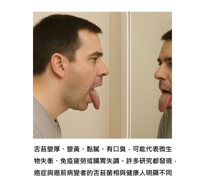 舌苔是身體發出的健康預警 - 早上照鏡子時，有沒有注意到它在說話？