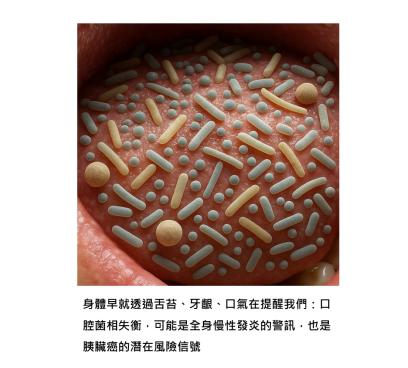 口腔菌失衡, 胰臟癌風險飆三倍 - 嘴巴其實藏著胰臟的秘密