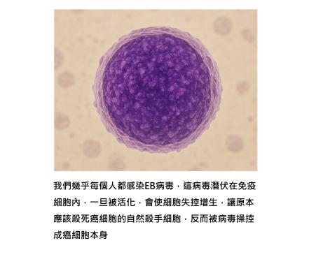 以為只是鼻竇炎或過敏？常見的EB病毒如何誘發致命的NK/T細胞淋巴癌