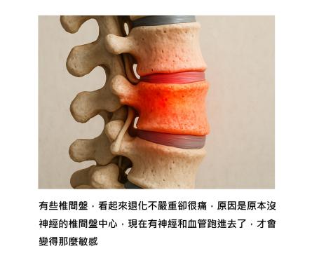 背痛不是老化的必然 - 從神經長入椎間盤，到日常修復的轉機