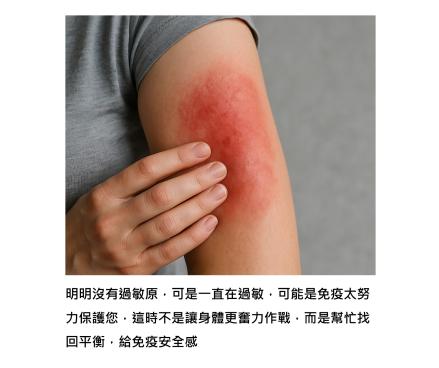 沒有過敏原,可是一直在過敏 – 認識IgE自體過敏