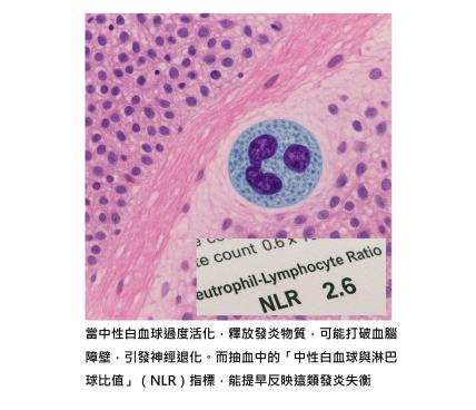 失智從大腦發炎開始 - 原來白血球數字早有跡可循