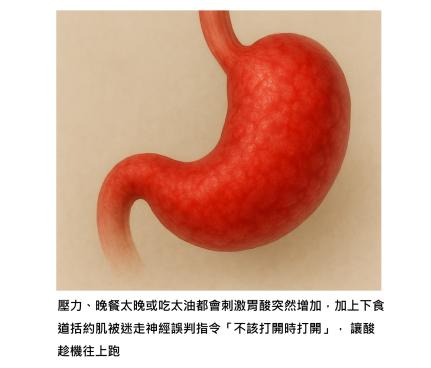 胃食道逆流的真正破口 – 胃酸、神經、括約肌的節奏失衡,也是我們生活失衡的縮影