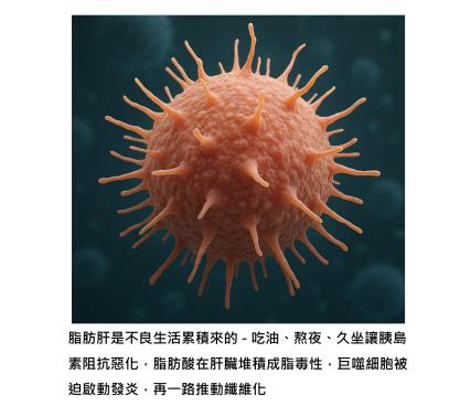 巨噬細胞才是決定脂肪肝命運的關鍵 - 吃油、久坐、熬夜之前先想一下巨噬細胞的感受