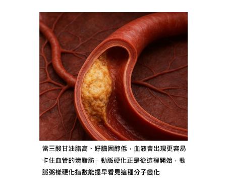 不要等到心肌梗塞或中風發生 - 抽血報告其實早已透露動脈粥樣硬化的方向