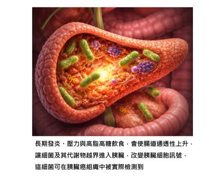 當腸道失守、壞菌進駐胰臟 - 胰臟癌風險，就此被打開