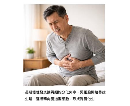 胃腸化生是一段累積的警訊 - 當胃被迫改走「腸子的路」,癌前風險開始出現