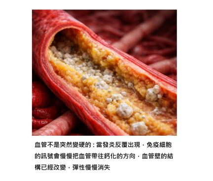 健檢看到「血管鈣化」該擔心嗎？它對健康的真正意義