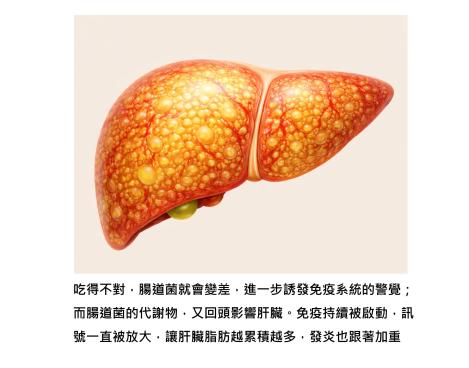 脂肪肝，是身體在「慢慢失去平衡」的訊息