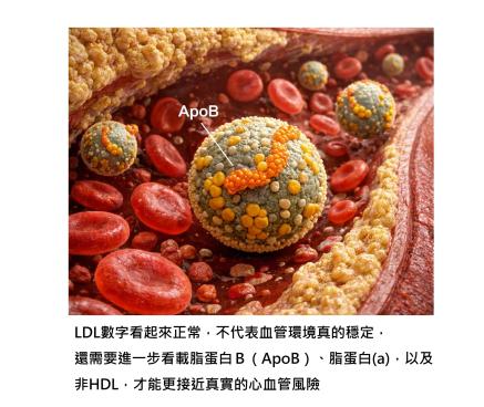 膽固醇正常,為什麼還會動脈硬化?關鍵不只看 LDL,還要看 ApoB 與非HDL