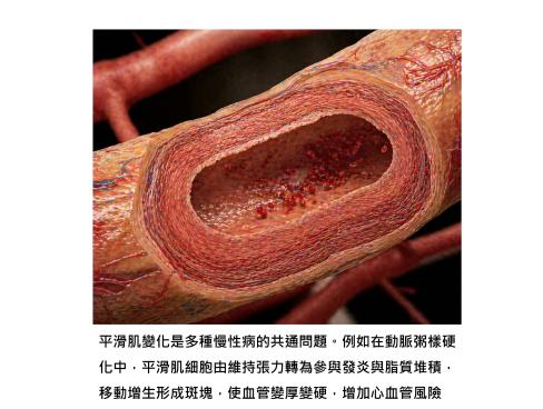 血管硬化、氣喘、腸胃不順，背後可能是同一個關鍵：平滑肌細胞